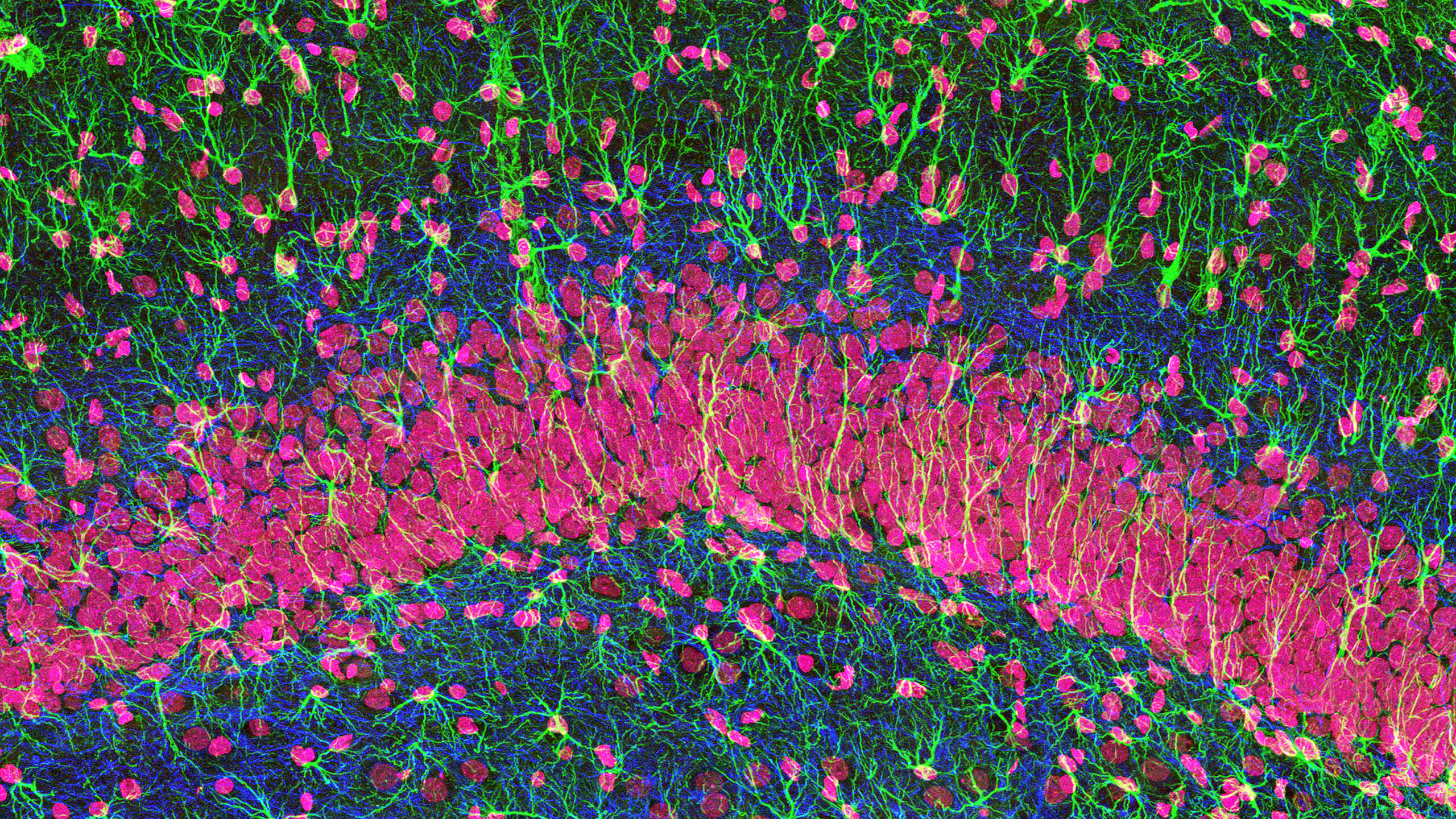 Image: Hippocampus brain tissue shown in relationship to PTSD.